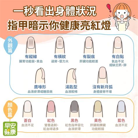 食指指甲下彎|「指甲」洩漏你的健康！「3種現象」看出貧血、心血。